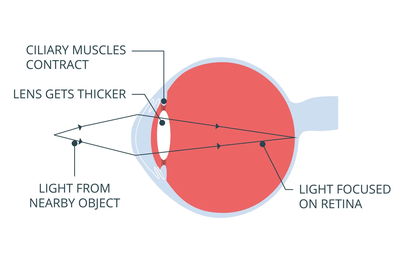 iSequalTo eye lens contraction educational diagram